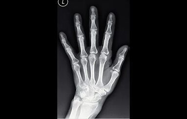 An Overview of Digital Radiography