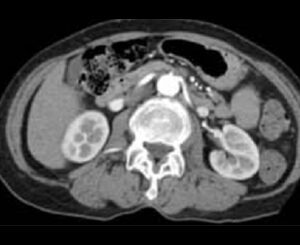 Radiological Services with a brain scan