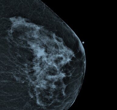 Quality Assurance in Digital Mammography