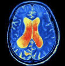 Special Procedures in Radiography Digital Angiography
