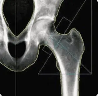 A Xray image of bones of a body part