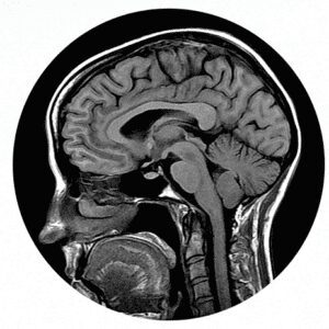 An Introduction to MRI Image OF A Person Head