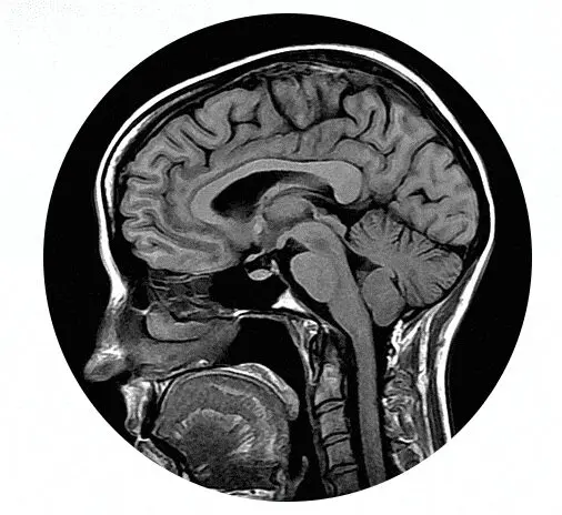 An Introduction to MRI Image OF A Person Head
