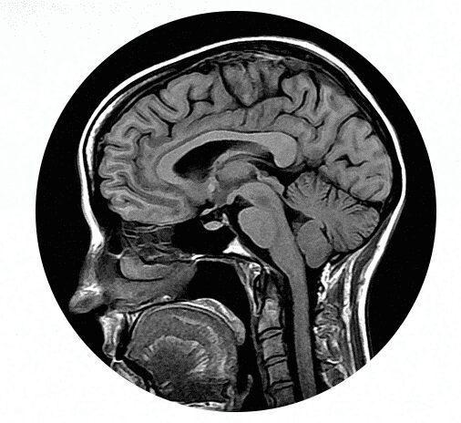 Introduction to MRI
